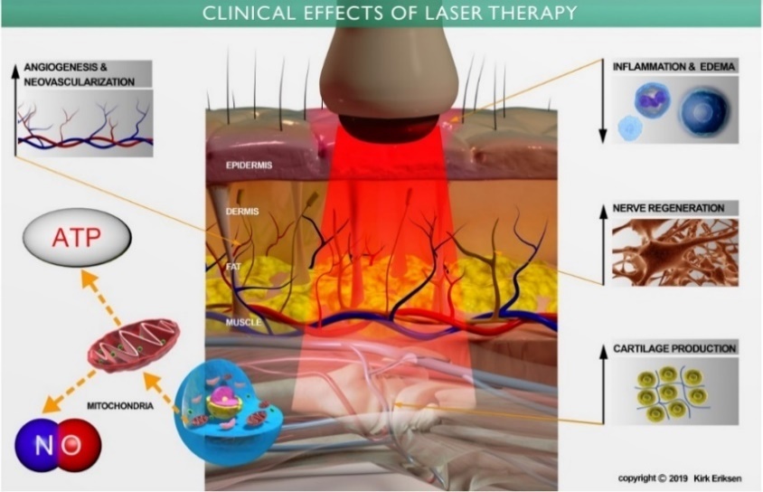 Clinical effects of laser therapy diagram
