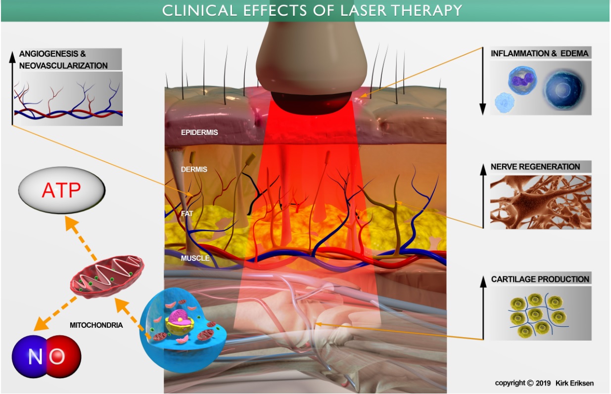 Photodynamics clinical science visual from presentation page 7