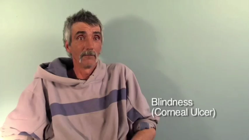 Blind in One Eye | Bob's Vision Recovery Journey with Phototherapy | Dr. Syed
